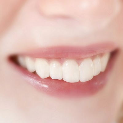 białe zęby