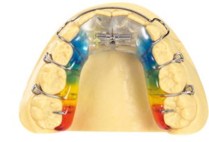 aparat na ortodontyczny