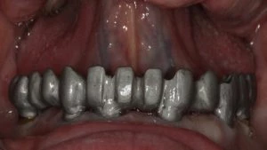 zęby 5