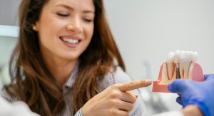 implant ludzkich zębów